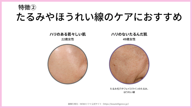 【NEWAリフト使用レビュー！】人気美顔器の特徴・口コミ・価格・評判など〜たるみ・ほうれい線ケアにおすすめ〜