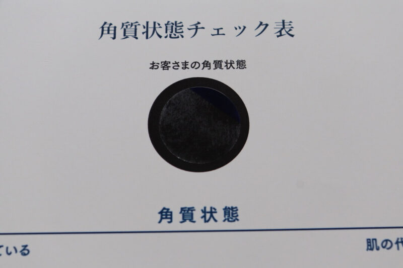 【タカミスキンピール】実感した変化や効果が出るまでの期間は？噂通りすごい！