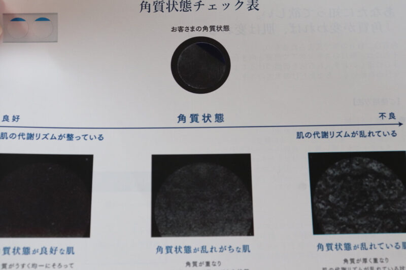 【タカミスキンピール】実感した変化や効果が出るまでの期間は？噂通りすごい！