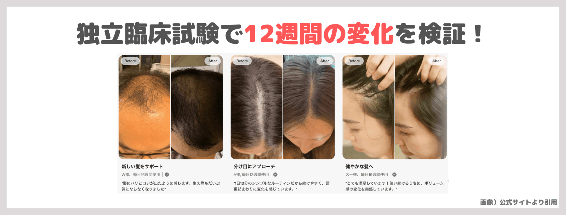 カレントボディ LED頭皮・頭髪ケアデバイス 使用レビュー!口コミ・効果・評判・感想・特徴など